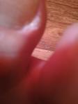 Болит большой палец на ноге у ногтя фото 1