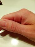 Болит палец фото 2
