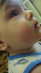 Прыщи, покраснение на щеках у ребенка до года без зуда фото 4