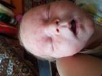 Высыпания у новорожденного на лице помогите фото 1