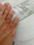 Опух палец на ноге фото 1