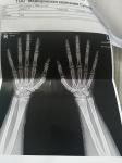 Рентген кисти рук и запястья фото 1