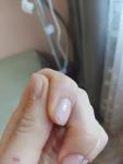 Полоска на ногте на указательном пальце фото 1