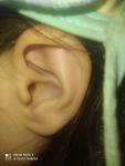 Уши болят у ребенка фото 1
