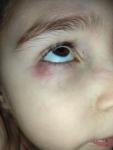 Проблемы с глазами у ребенка фото 1