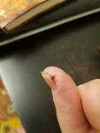 Трещины на пальцах рук у ногтя фото 3