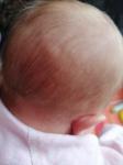 Сыпь или аллергия у младенца фото 1