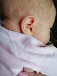 Сыпь или аллергия у младенца фото 3