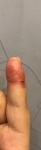 Проблемы с пальцами рук и ногтями фото 3