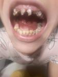 Вопрос о зубах фото 1
