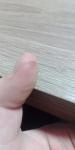 Коричневые пятна на кончиках пальцев возле ногтя фото 4