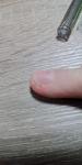 Коричневые пятна на кончиках пальцев возле ногтя фото 5