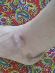 Сухой каричневый Пятно на ноге фото 1