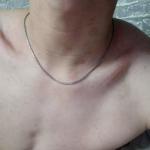 Большие коричневые пятна на шеи и плечах фото 1