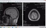 Помогите описать МРТ головного мозга фото 1