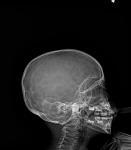Рентген головы ребенка фото 1