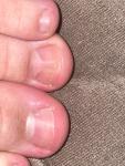 Полоска посередине ногтя, изменение лунулы фото 3