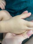 Шершавые пятна на руках у ребенка фото 4