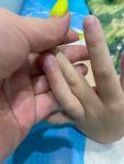 Сыпь по всему телу у ребенка, без признаков инфекционного заболевания фото 2