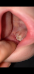 Аномальный молочный зуб? фото 2