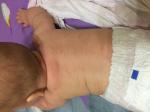 Красные пятна на спине, шее и голове у ребёнка 5 месяцев фото 2