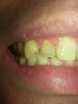 Потемнее зубной эмали фото 1