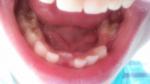 Коренные зубы у ребенка фото 1