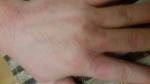 Ужасные пятна на руках после работы с пылью и ржавчиной фото 1
