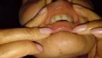 Болит верхняя губа внутри где слизистая и краснеет фото 1