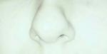 Кривой нос фото 1