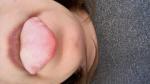 Проблема со слизистой губ и языка фото 2