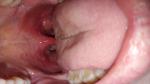 Красное горло и миндалины фото 1