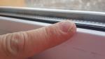 Ямки и неровности на ногтях рук фото 3