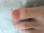 Чёрные точки на ногте пальца руки фото 1