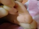 Родинка между пальцев у ребенка фото 2