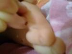 Родинка между пальцев у ребенка фото 1