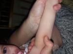 Белое пятно на руке у ребенка фото 2