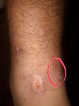 Зудящие раны на ноге фото 1