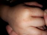 Сыпь у ребенка на ладошках руках и выше колена фото 1
