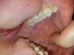 Вопрос о состоянии слизистой оболочки рта фото 1