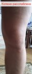 Болит выше колена при прыжке фото 2