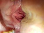 Рак горла болит горло фото 1