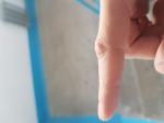 Опасен ли порез в районе сустава пальца? фото 1