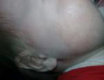 Аллергия у грудного ребенка фото 2