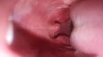 Больное горло у 3х летнего ребенка фото 3