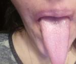 Щиплет язык и губы фото 6