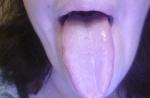 Щиплет язык и губы фото 1