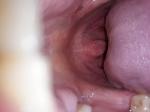 Ощущение кисло-солёного в горле, боли фото 4