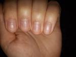Странные дуги на ногтях фото 1