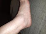 Боль в области щиколотки на одной ноге фото 1